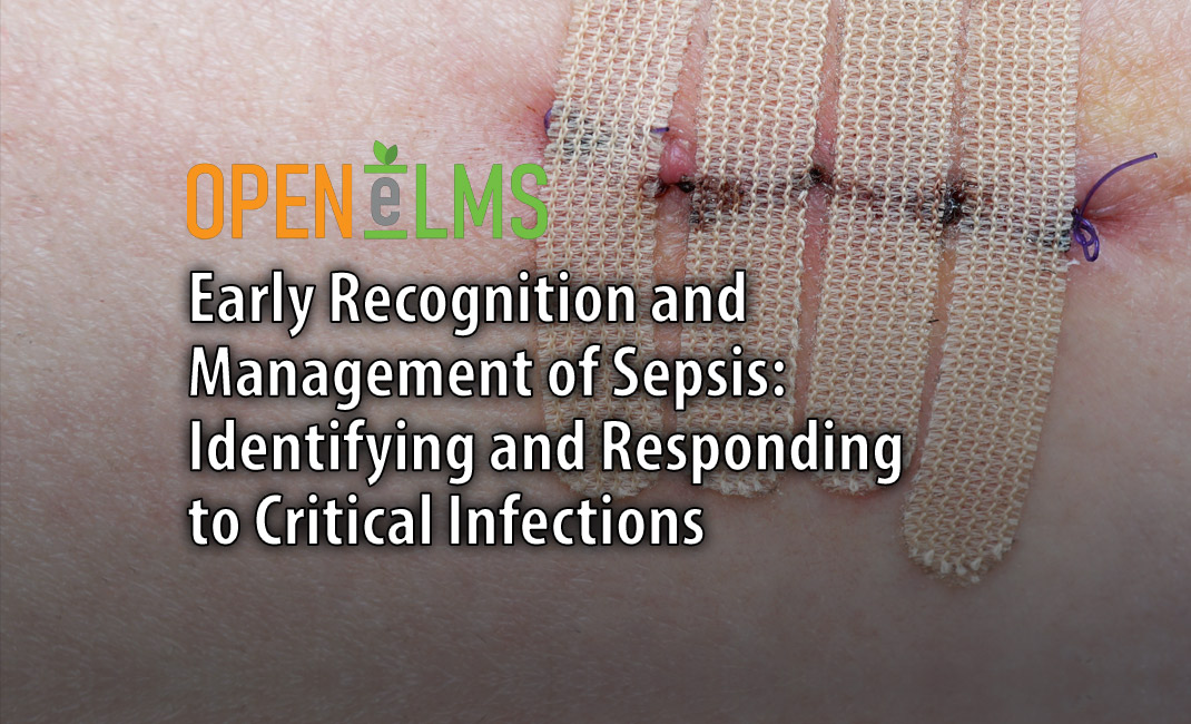Early Recognition and Management of Sepsis Identifying and Responding to Critical Infections